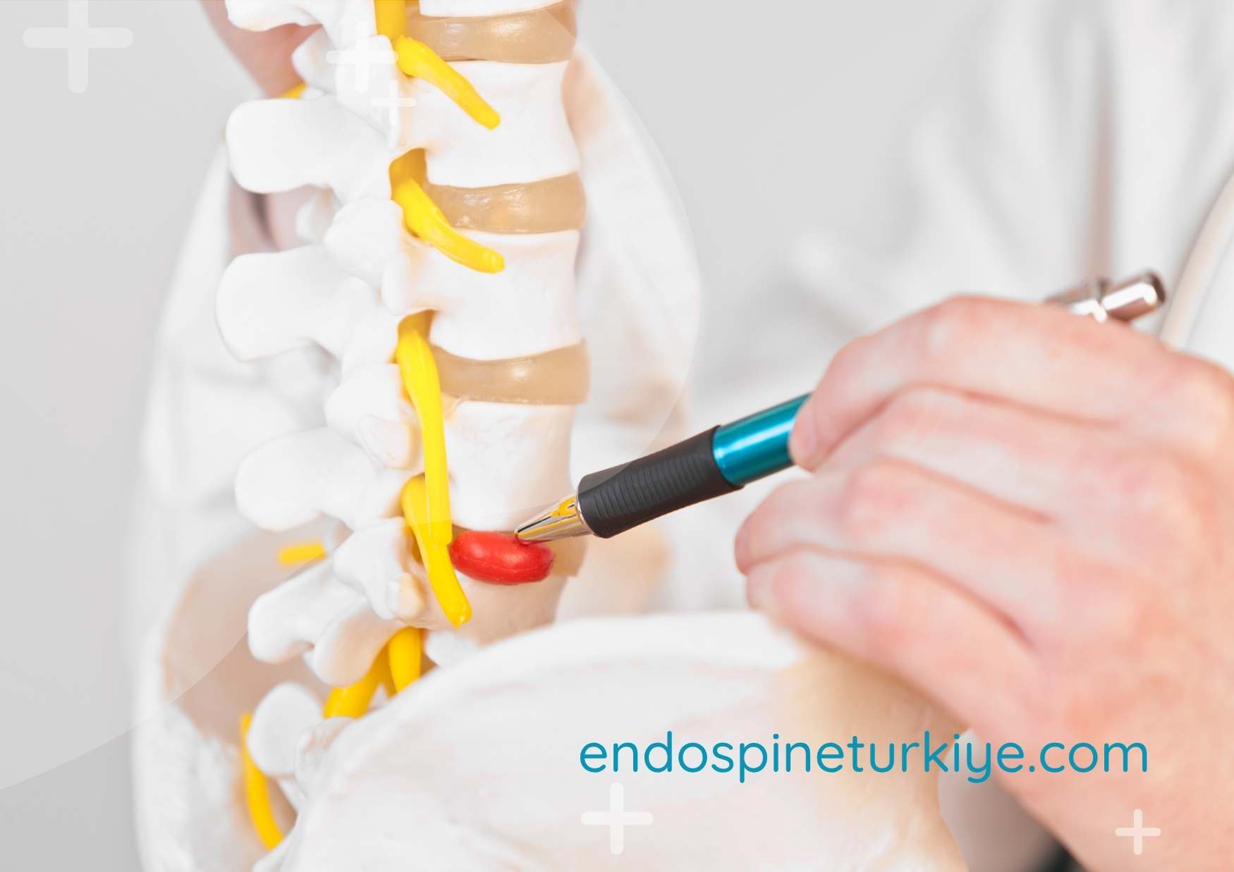 Bel fıtığı ameliyatı sonrası iyileşme süreci